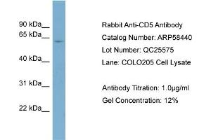 Western Blotting (WB) image for anti-CD5 (CD5) (N-Term) antibody (ABIN2774224)