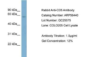 WB Suggested Anti-CD5  Antibody Titration: 0. (CD5 Antikörper  (N-Term))