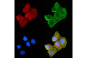 ABIN6265052 and ABIN6272430 staining Hela cells(30 min of UV treatment) by IF/ICC. (SH3BGR Antikörper  (Internal Region))