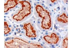 ABIN185555 (3µg/ml) staining of paraffin embedded Human Kidney. (IFT88 Antikörper  (C-Term))