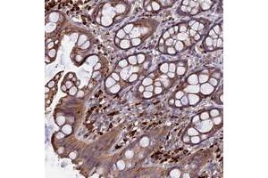 Immunohistochemical staining of human rectum with RLTPR polyclonal antibody  shows moderate cytoplasmic positivity in glandular cells at 1:50-1:200 dilution. (RLTPR Antikörper)