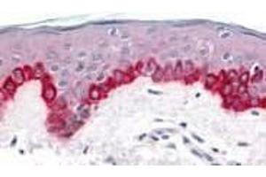 Immunohistochemistry of Apaf1 in human skin tissue with Apaf1 (CT) antibody at 20 μg/ml. (APAF1 Antikörper  (C-Term))