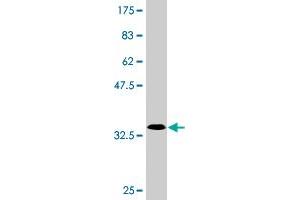 Western Blot detection against Immunogen (33. (SLC25A23 Antikörper  (AA 2-74))