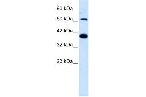 WB Suggested Anti-GRIK2 Antibody Titration:  1. (GRIK2 Antikörper  (N-Term))