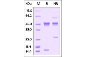 SDS-PAGE (SDS) image for Activin A (ACVA) (AA 21-426) (Active) protein (His tag) (ABIN4949124)