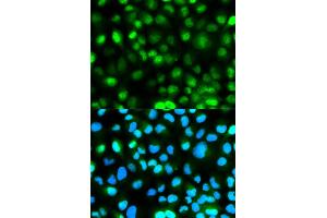 Immunofluorescence analysis of HeLa cells using ATXN3 antibody. (Ataxin 3 Antikörper)