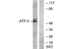 Western blot analysis of extracts from LOVO cells, using ATF2 (Ab-73 or 55) Antibody.