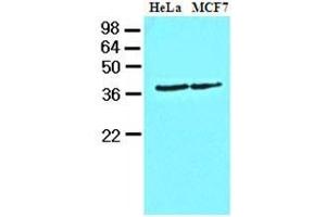Cell lysates of HeLa and MCF7 (40 ug) were resolved by SDS-PAGE, transferred to nitrocellulose membrane and probed with anti-human Casein Kinase 1 alpha (1:1000). (CSNK1A1 Antikörper  (AA 1-337))