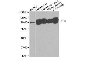 Western blot analysis of extracts of various cell lines, using ALB antibody. (Albumin Antikörper)