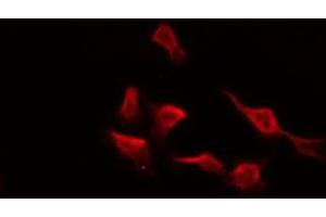 ABIN6275985 staining HepG2 by IF/ICC. (Endothelin-1 Receptor Antikörper  (C-Term))
