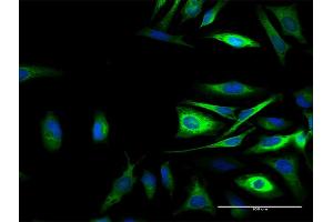 Immunofluorescence of purified MaxPab antibody to CAST on HeLa cell. (Calpastatin Antikörper  (AA 1-686))