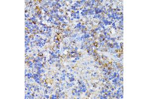 Immunohistochemistry of paraffin-embedded mouse spleen using CAD antibody (ABIN6130029, ABIN6137837, ABIN6137838 and ABIN6224367) at dilution of 1:100 (40x lens). (CAD Antikörper  (AA 1650-1900))