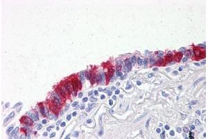 Human Lung, respiratory epithelium: Formalin-Fixed, Paraffin-Embedded (FFPE) (ARVCF Antikörper  (AA 863-963))