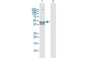Western Blot analysis of HYAL3 expression in transfected 293T cell line by HYAL3 MaxPab polyclonal antibody.