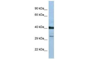 Western Blot showing PTGDR antibody used at a concentration of 1 ug/ml against THP-1 Cell Lysate (PTGDR Antikörper  (C-Term))