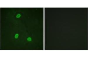 Immunofluorescence analysis of HeLa cells, using NIPA (Ab-354) Antibody. (ZC3HC1 Antikörper  (AA 320-369))