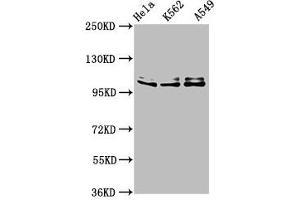 Western Blot Positive WB detected in: Hela whole cell lysate, K562 whole cell lysate, A549 whole cell lysate All lanes: XAB2 antibody at 3 μg/mL Secondary Goat polyclonal to rabbit IgG at 1/50000 dilution Predicted band size: 101 kDa Observed band size: 101 kDa (XAB2 Antikörper  (AA 750-840))
