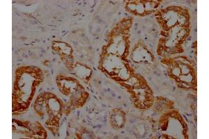 IHC image of ABIN7144437 diluted at 1:100 and staining in paraffin-embedded human kidney tissue performed on a Leica BondTM system.