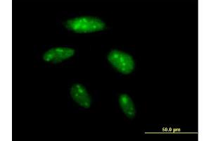 Immunofluorescence of purified MaxPab antibody to BAZ2B on HeLa cell. (BAZ2B Antikörper  (AA 1-643))