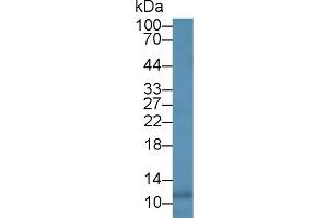 Detection of IL8 in Human Leukocyte lysate using Monoclonal Antibody to Interleukin 8 (IL8) (IL-8 Antikörper  (AA 23-101))