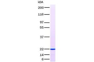 Western Blotting (WB) image for Tumor Necrosis Factor (Ligand) Superfamily, Member 11 (TNFSF11) (Transcript Variant 1) (Active) protein (ABIN2713549)