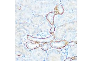 Immunohistochemistry of paraffin-embedded mouse kidney using NDUFV1 Rabbit pAb  at dilution of 1:100 (40x lens).