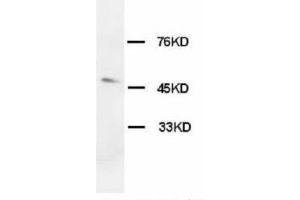 Image no. 2 for anti-Hypocretin (Orexin) Receptor 1 (HCRTR1) (C-Term) antibody (ABIN1492942) (HCRTR1 Antikörper  (C-Term))