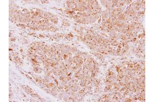 Immunohistochemistry (IHC) image for anti-NADH Dehydrogenase (Ubiquinone) Fe-S Protein 5, 15kDa (NADH-Coenzyme Q Reductase) (NDUFS5) (Center) antibody (ABIN2855190)