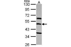 WB Image Sample (30 ug of whole cell lysate) A: A431 , 10% SDS PAGE antibody diluted at 1:2000