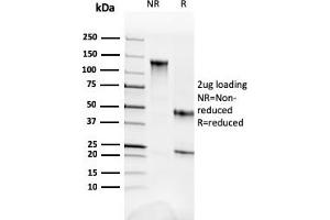 SDS-PAGE Analysis Purified Fodrin Mouse Monoclonal Antibody (SPTAN1/3352). (SPTAN1 Antikörper  (AA 2351-2475))