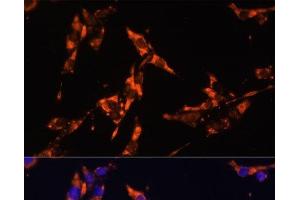 Immunofluorescence analysis of HeLa cells using IL18 Polyclonal Antibody at dilution of 1:100. (IL-18 Antikörper)