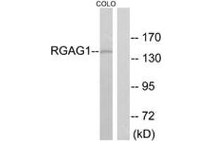 Western blot analysis of extracts from COLO cells, using RGAG1 Antibody. (RGAG1 Antikörper  (AA 1331-1380))