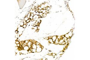Immunohistochemistry of paraffin-embedded human liver using [KO Validated] Cytokeratin 8 Rabbit pAb (ABIN3021287, ABIN3021288, ABIN3021289, ABIN1513142 and ABIN1514287) at dilution of 1:50 (40x lens). (KRT8 Antikörper  (AA 1-483))