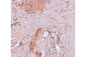 Immunohistochemical staining of human colon cells with RBM35A polyclonal antibody  at 2. (ESRP1 Antikörper  (N-Term))