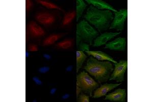 ABIN6260917 and ABIN6278560 staining  cells by IF/ICC.