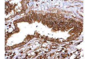Immunohistochemistry (IHC) image for anti-Thymidylate Synthetase (TYMS) antibody (ABIN2855587)