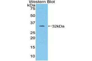 Western Blotting (WB) image for anti-Janus Kinase 1 (JAK1) (AA 596-841) antibody (ABIN3205083) (JAK1 Antikörper  (AA 596-841))