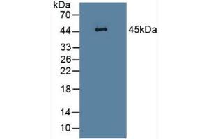 Detection of LEI in Rat Heart Tissue using Polyclonal Antibody to Leukocyte Elastase Inhibitor (LEI) (SERPINB1 Antikörper  (AA 17-332))