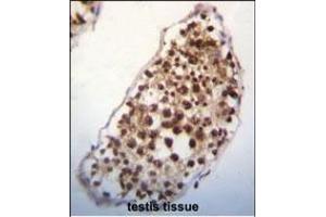 SNRK Antibody (Center) (ABIN652303 and ABIN2841382) immunohistochemistry analysis in formalin fixed and paraffin embedded human testis tissue followed by peroxidase conjugation of the secondary antibody and DAB staining. (SNRK Antikörper  (AA 320-349))