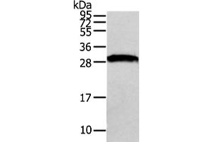 Western Blotting (WB) image for anti-VAMP (Vesicle-Associated Membrane Protein)-Associated Protein A, 33kDa (VAPA) antibody (ABIN5962090)