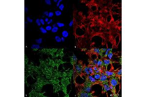 Immunocytochemistry/Immunofluorescence analysis using Rabbit Anti-GABARAP Polyclonal Antibody . (GABARAP Antikörper  (N-Term) (APC))