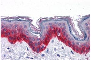 Human Skin: Formalin-Fixed, Paraffin-Embedded (FFPE) (KRT81 Antikörper  (AA 1-203))