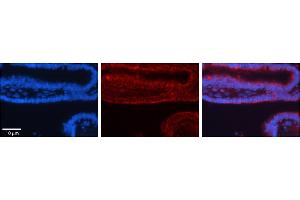 Human Bronchial Epithelial Tissue; Rabbit Anti-TRIM32 Antibody . (TRIM32 Antikörper  (C-Term))
