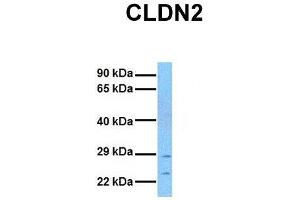 Host:  Rabbit  Target Name:  CLDN2  Sample Tissue:  Human MCF7  Antibody Dilution:  1. (Claudin 2 Antikörper  (N-Term))