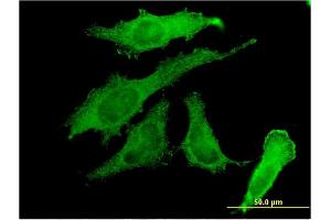 Immunofluorescence of monoclonal antibody to RBPMS on HeLa cell.