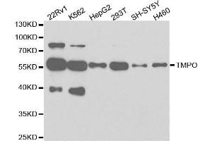 Western blot analysis of extracts of various cell lines, using TMPO antibody. (Thymopoietin Antikörper  (AA 1-410))