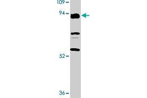 Western blot analysis of TLR3 expression in K-562 cell lysate with TLR3 polyclonal antibody  at 2 ug/mL . (TLR3 Antikörper  (N-Term))