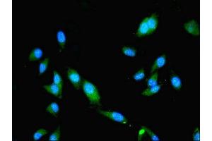 Immunofluorescence (IF) image for anti-Src-Like-Adaptor (SLA) (AA 2-276) antibody (ABIN7170672)