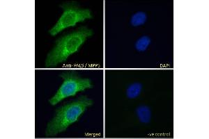ABIN185150 Immunofluorescence analysis of paraformaldehyde fixed HeLa cells, permeabilized with 0. (MPP5 Antikörper  (N-Term))