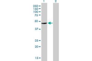 Western Blot analysis of HADHB expression in transfected 293T cell line by HADHB MaxPab polyclonal antibody.